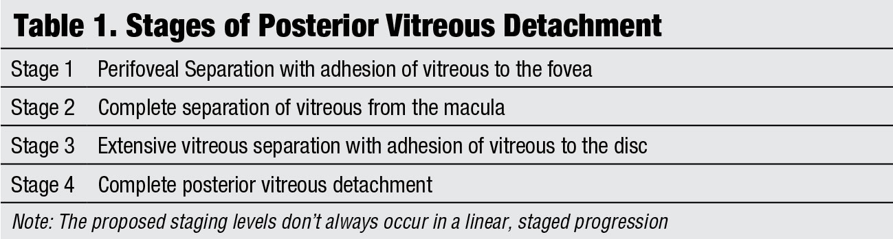 Stages of Posterior Vitreous Detachment