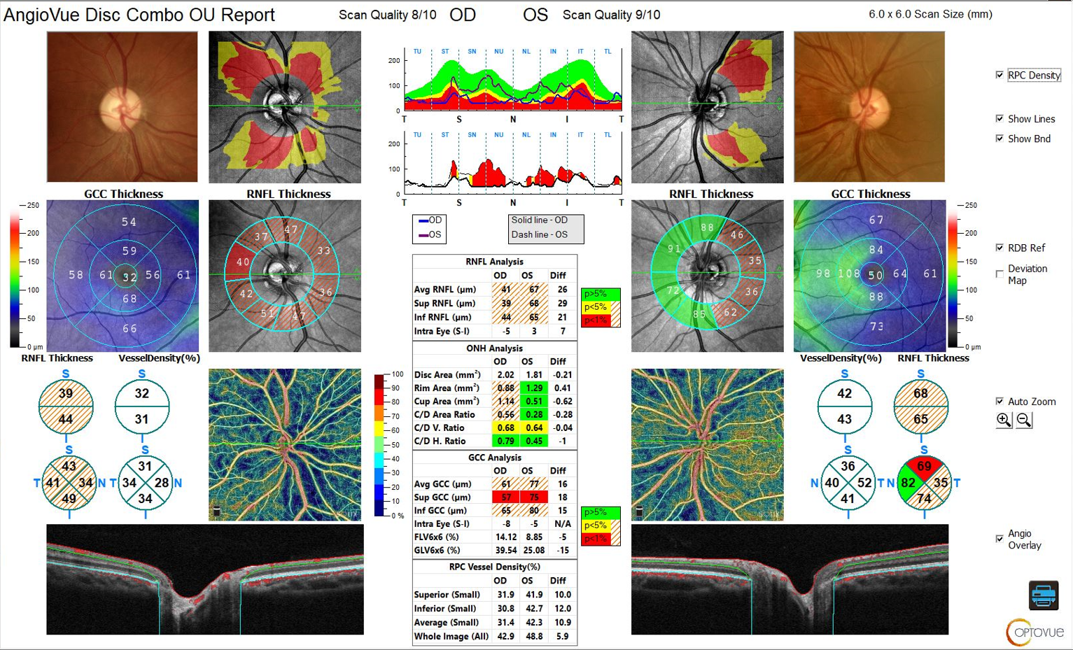 In this study, en face RNFL defects showed a greater correlation with visual field indices than did red-free RNFL defects.