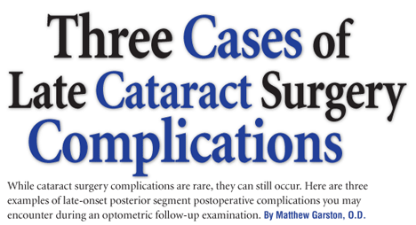 What are some complications that can happen from cataract surgery?