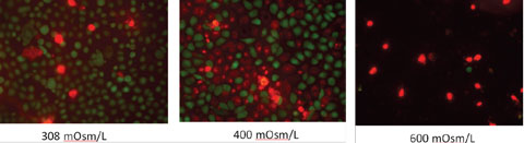 Effect of high osmolarity on corneal epithelial cells (200x magnification).