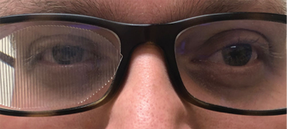What Are Prism Glasses and Do You Need Them?