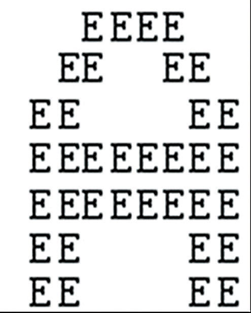 The SA patient will look at this image and see the smaller letters Es, but not the larger A they make up.