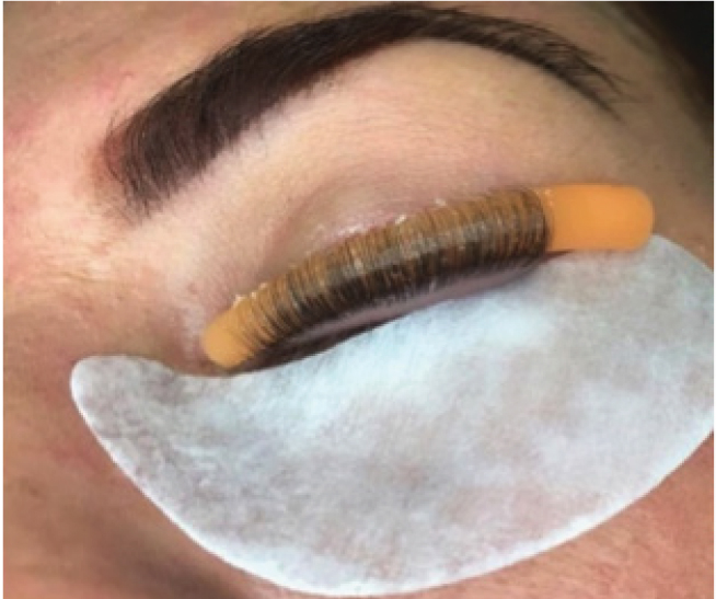 Fig. 3. Eyelash perming procedure.