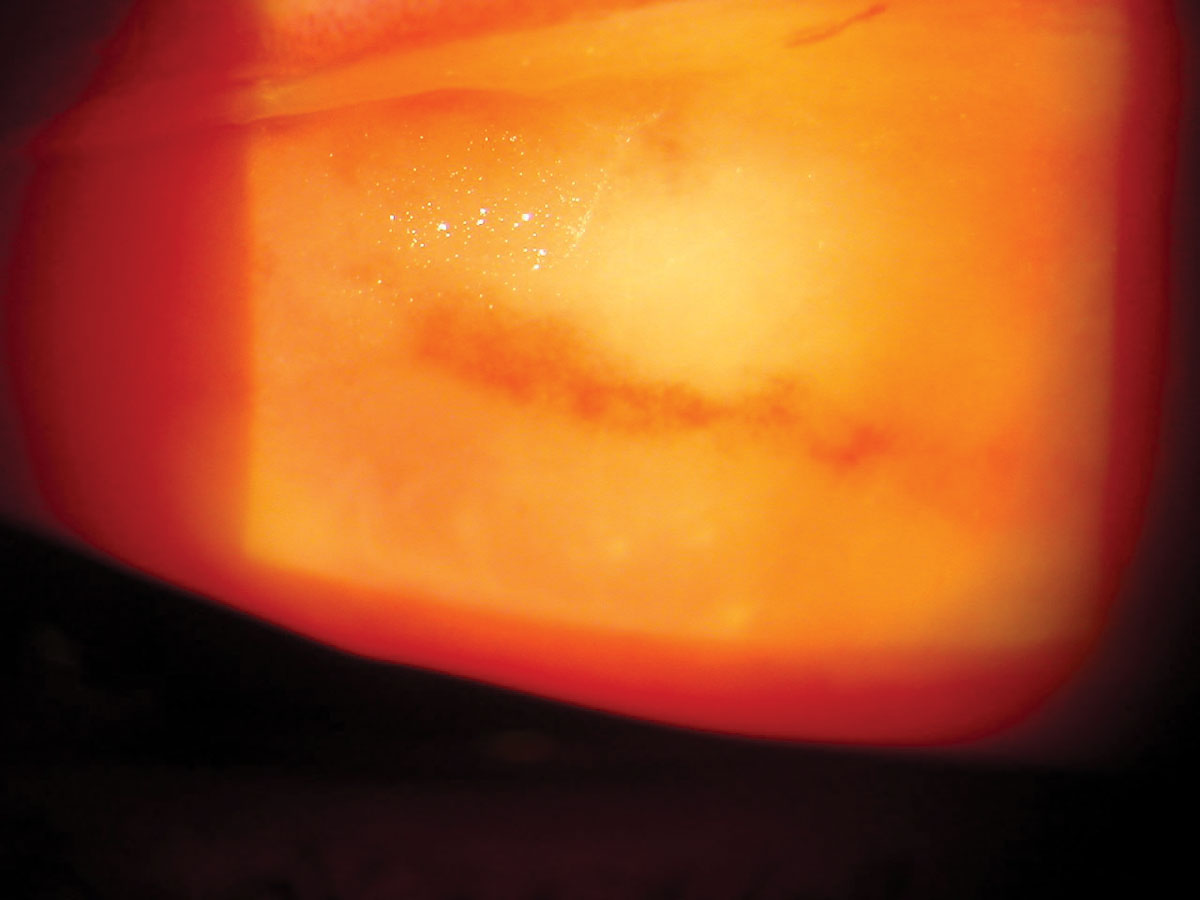 Did you identify the underlying condition causing this patient's distress?