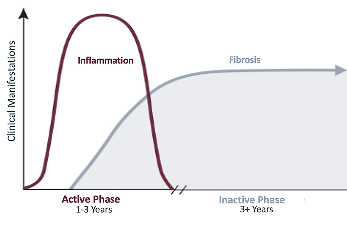 The disease process of TED usually follows the trajectory of Rundle’s curve.