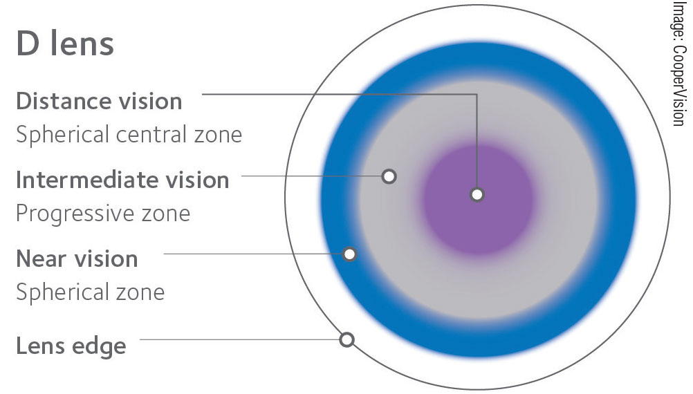 Fig. 3. CooperVision’s Proclear and Biofinity both employ a distance-center design that is an effective off-label option for myopia control.