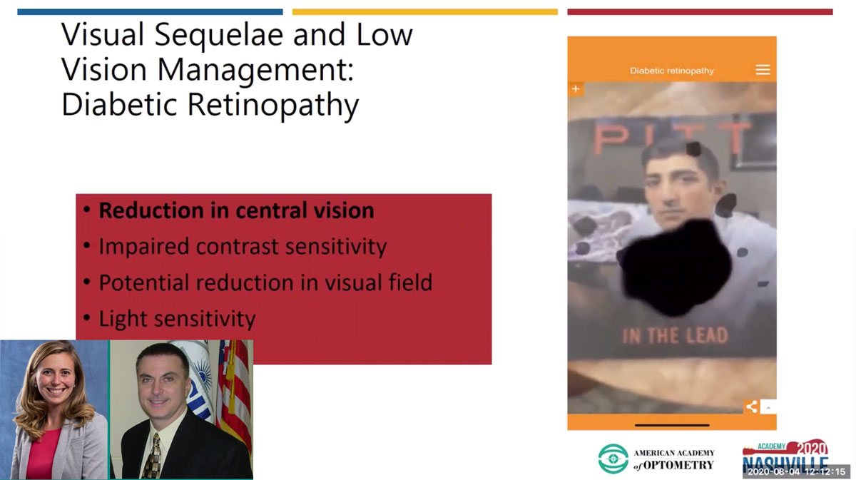 Dr. Kenny demonstrated the visual effects of diabetic retinopathy, including progressing central vision loss and reduced contrast sensitivity. 
