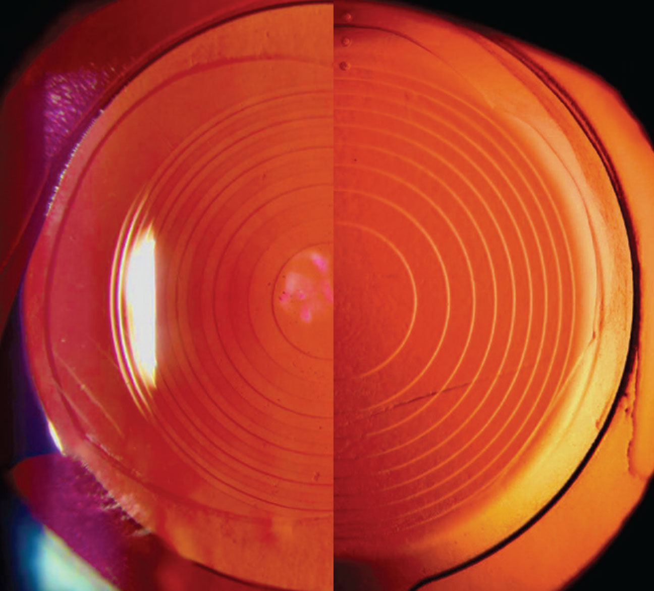 Side-by-side slit lamp view of the PanOptix (left) and the Symfony (right). The PanOptix has a smaller central optic and syncopated ring spacing.