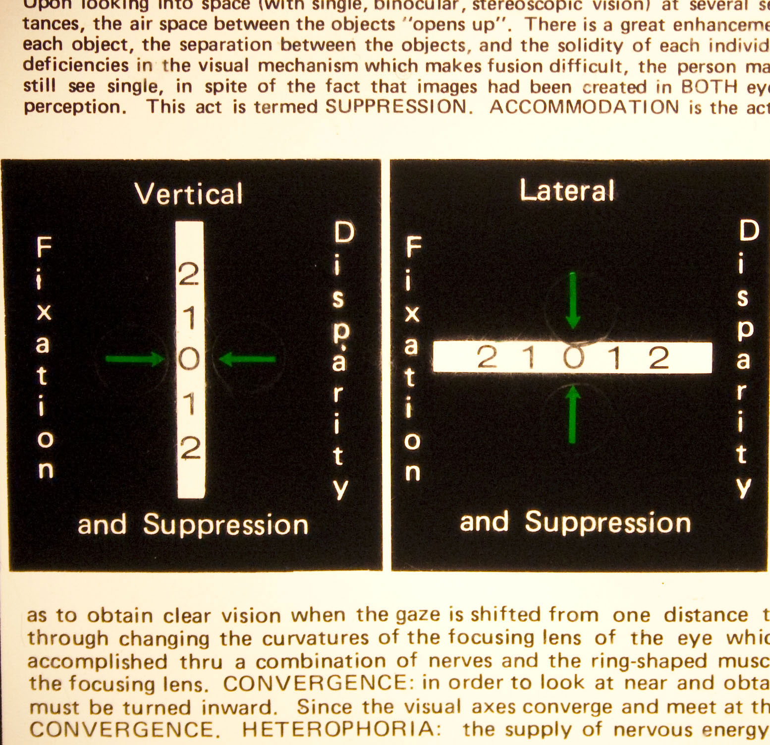 This is the central part of a Mallett card. Each of the green arrows has a circular-shaped Polaroid material over it. When viewed with Polaroid glasses, the arrow to the right on the vertical test and the upper arrow on the lateral test can be seen with the right eye, and the other two can be seen with the left. Everything else is seen with both eyes and acts as fusion locks.