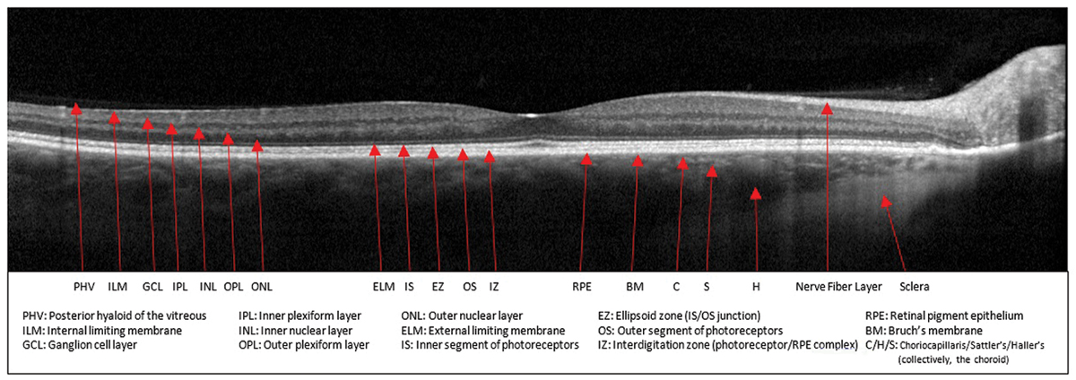 Fig. 1. Normal macular OCT with anatomic structures labeled.