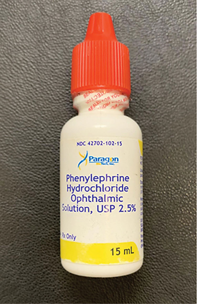 Phenylephrine should not be the sole drop used for dilated fundus examination, as it has a weaker mydriatic effect.