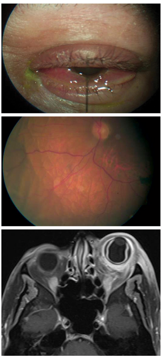 Figs. 1-3. What do these images suggest about the nature of this patient’s condition?