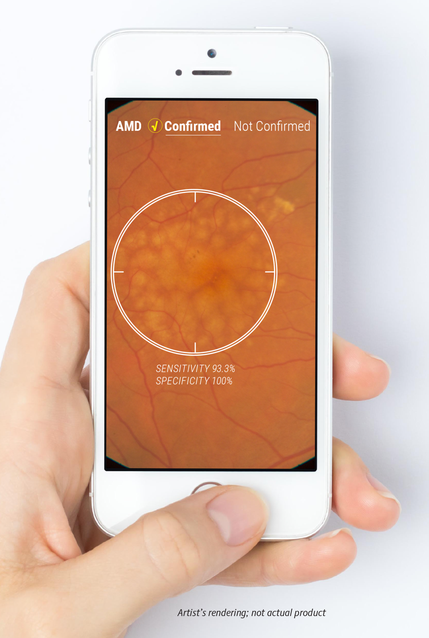 Soon, an app may be able to help providers determine whether a patient has AMD. 