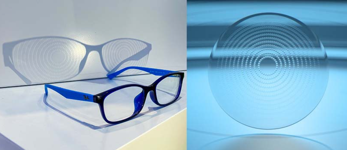 Essilor’s Stellest lenses are an emerging treatment option for myopia management. 