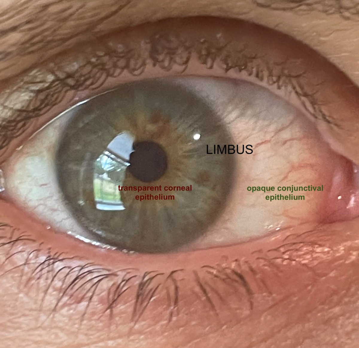 The limbus is the transition zone preventing the opaque epithelium from invading the clear cornea.