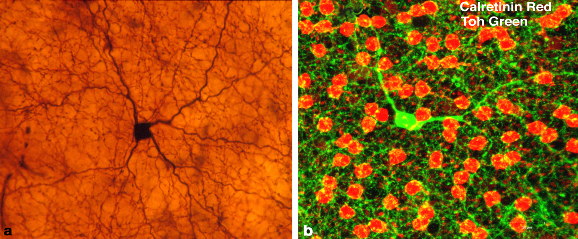 Dopaminergic amacrine cells in animal retina histology samples. Present in both the inner and outer plexiform layers, such cells may be a target for myopia control therapies in the future.