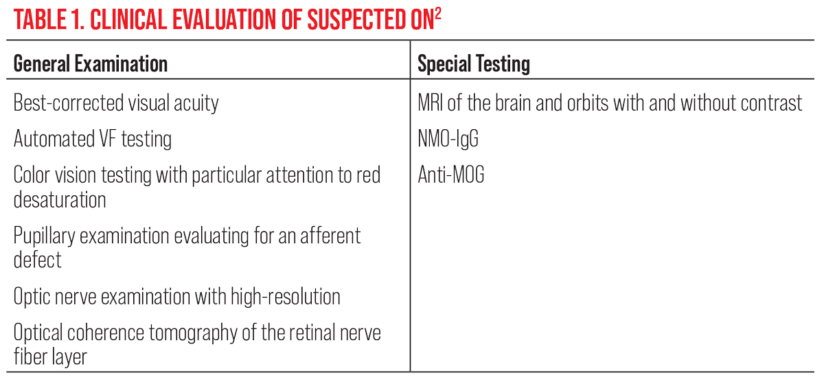 Table 1. Clinical Evaluation of Suspected ON
