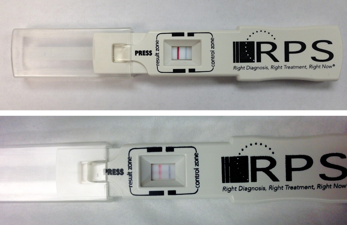 Fig. 2. Shown here are two positive point-of-care tests using the RPS Adeno Detector (Rapid Pathogen Screening). The blue line is the control; presence of the red line indicates a positive test result for Ad-Cs. The top image is prior to treatment with PVP-I; the bottom image is 24 hours post-treatment. 