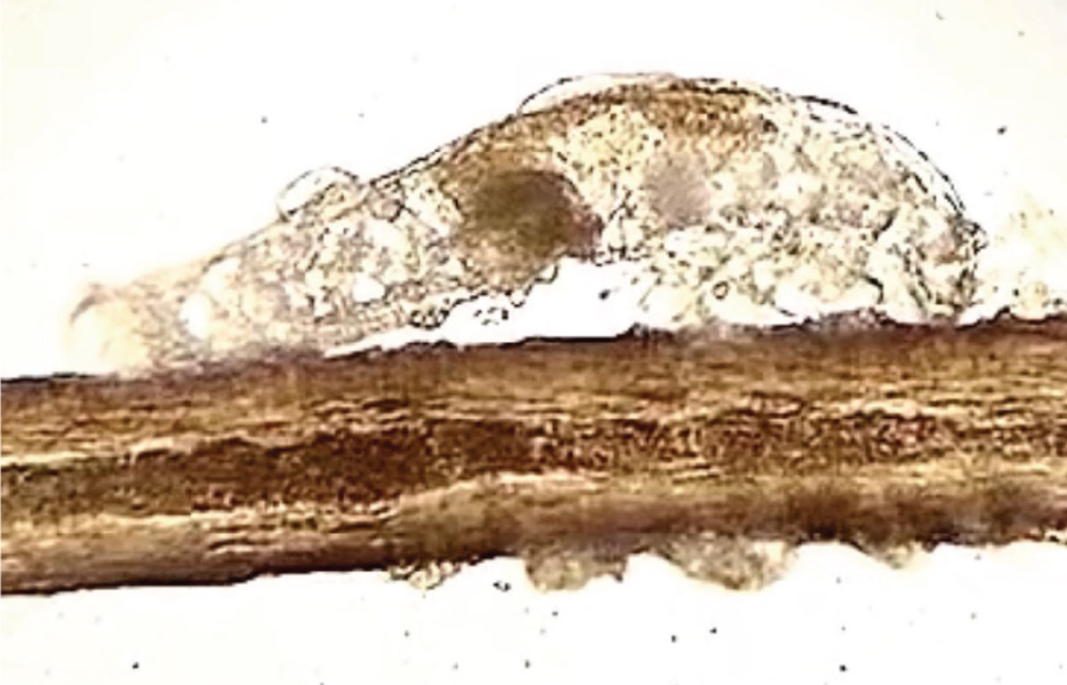 A close-up microscopy photo of a Demodex mite enjoying a meal of paracilia debris.