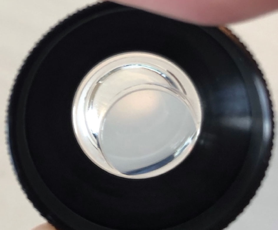 Fig. 6. An Abraham iridotomy YAG laser lens. Note the magnifying “button” that is offset in the lens.