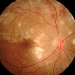 Be mindful of the increased risk of uveitis flare in patients who have received their COVID-19 vaccine.