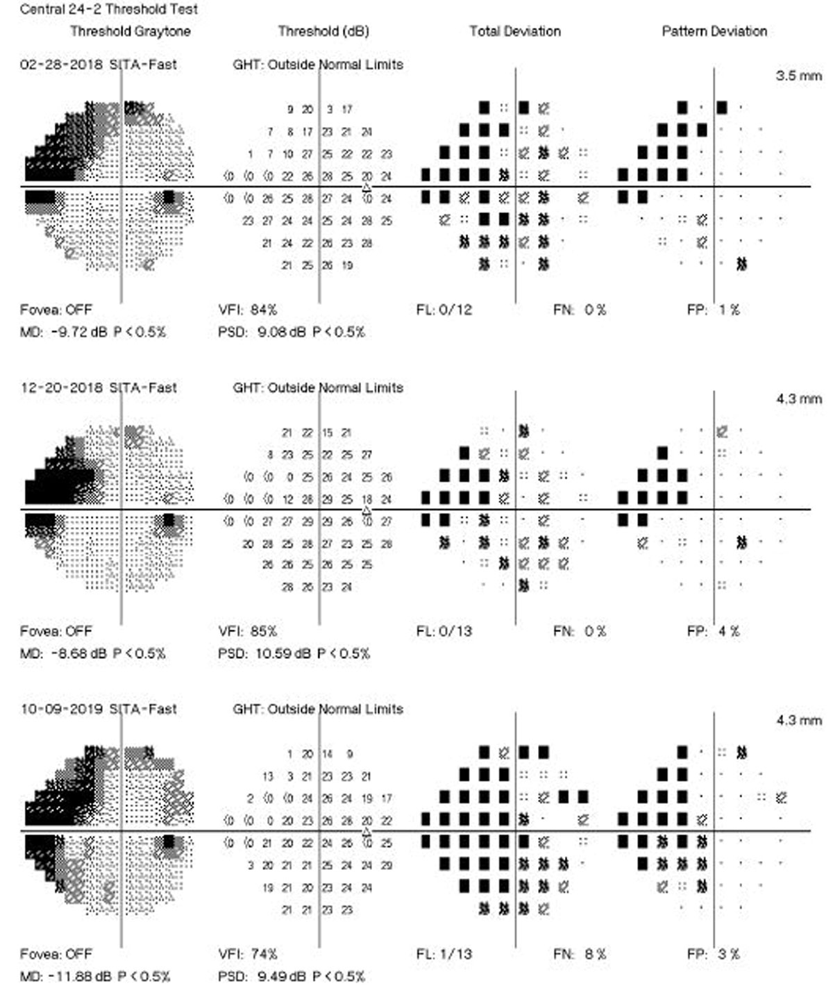 Visual field progression continued even with better medication adherence in this study.