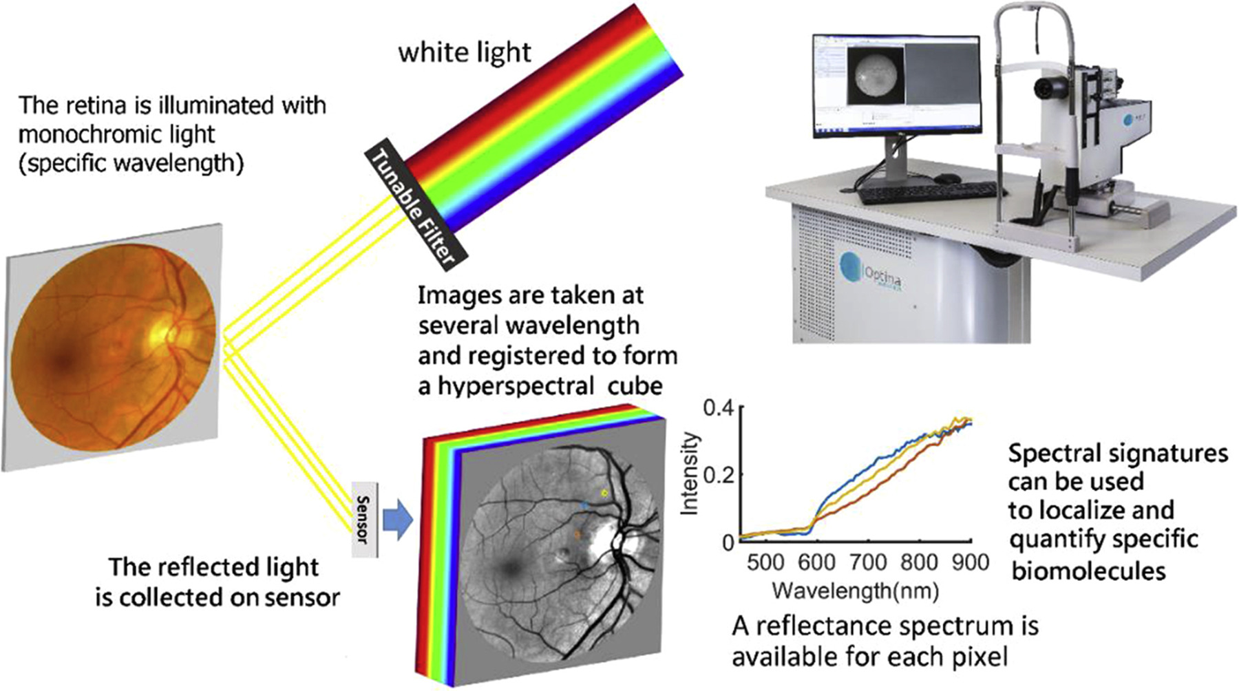 Hyperspectral imaging, though still impractical in a clinical setting, can detect the wavelength “signature” of amyloid beta in the retinas of Alzheimer’s patients.