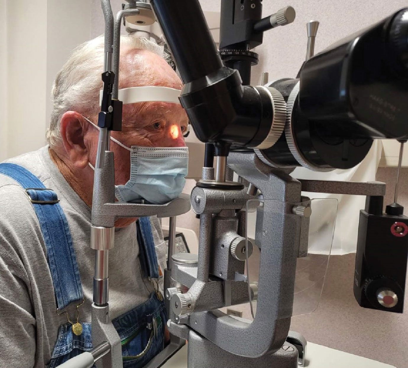 Fig. 3. Turning the ocular-light unit allows you to better visualize areas at the slit lamp that are otherwise hard to see if it is tangential to the area of interest. Here, we can more easily evaluate a nasal sidewall lesion.
