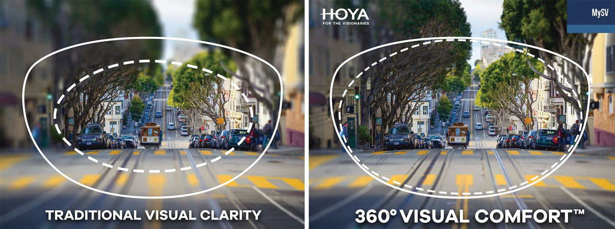 Attention to detail of the lens edge designs in the Hoya MySV lens not only reduces thickness in high prescriptions but also improves clarity of the wearer’s peripheral vision.