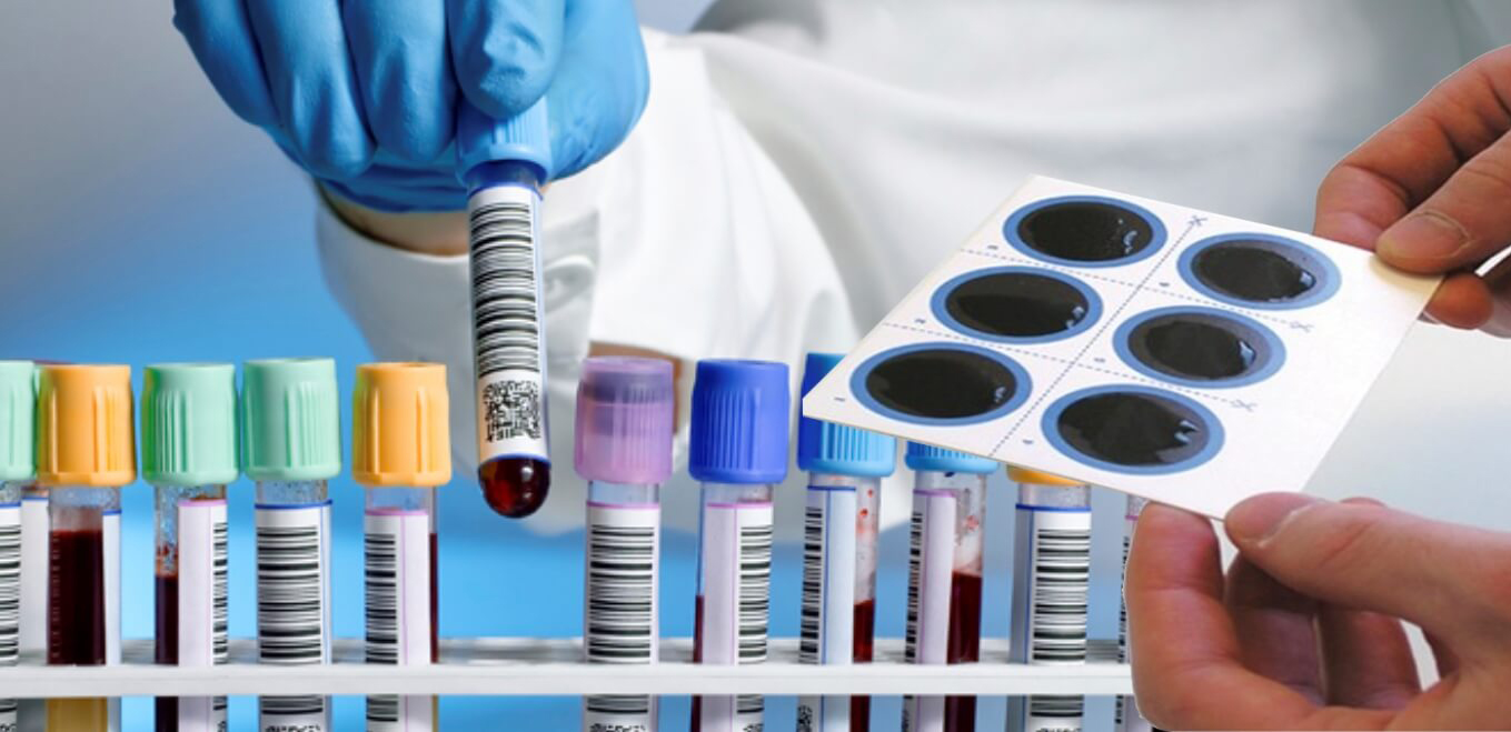 Conduct serology testing in cases of NCP to manage potential underlying vitamin abnormalities.