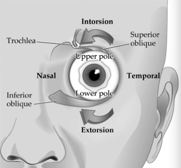 Patients with ocular torsional instability but no signs of infantile or early-onset strabismus may require neuroimaging to rule out neurovestibular or cerebellar disease.