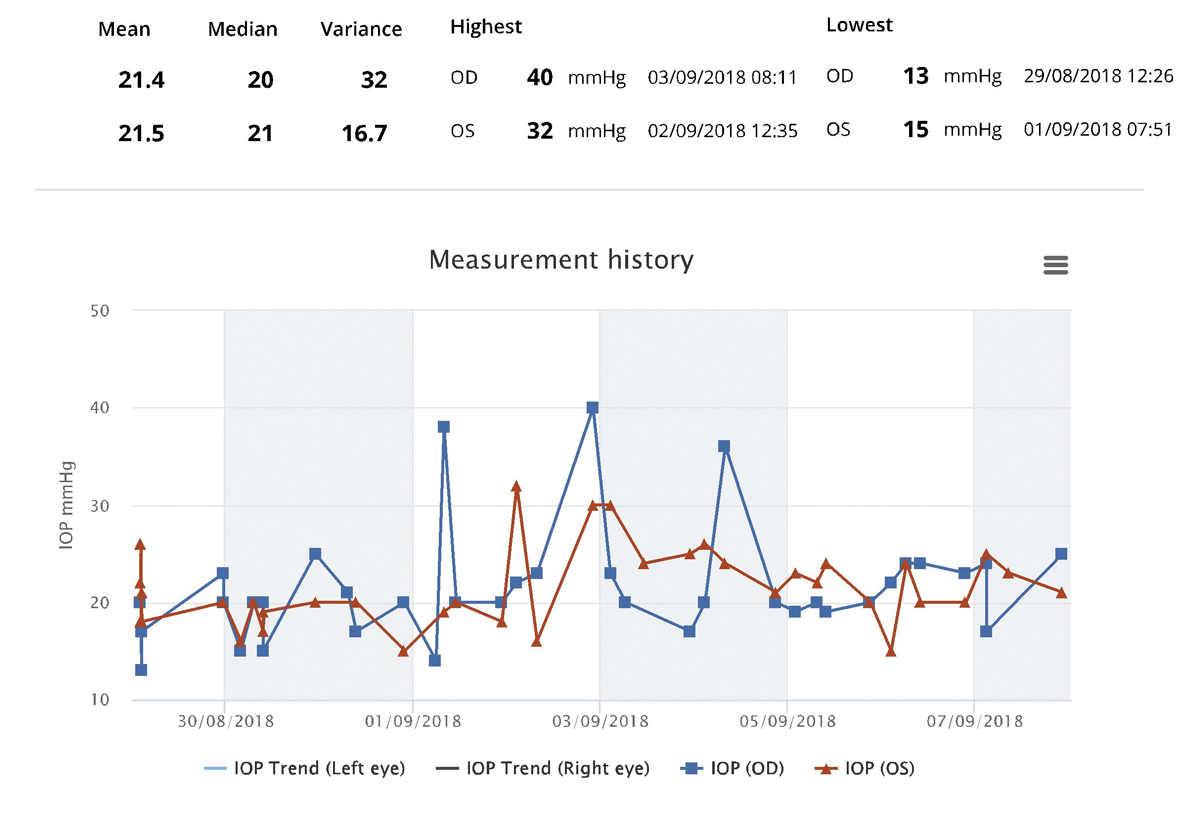 Fig. 3. iCare Home monitoring phasing results for a patient with pseudoexfoliation syndrome and no structural or functional evidence of glaucoma. In-office IOP measurements for this patient ranged between 14mm Hg to 19mm Hg OD and 15mm Hg to 19mm Hg OS.