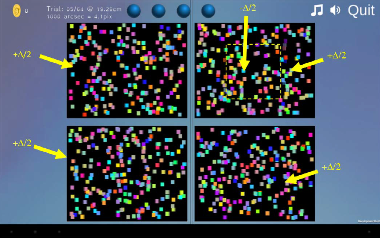 Screenshot showing the tablet-based Asteroid test stimulus, with four patches of random-dot patterns. The top right patch contains a target region perceived by the patient to be in front of the screen.