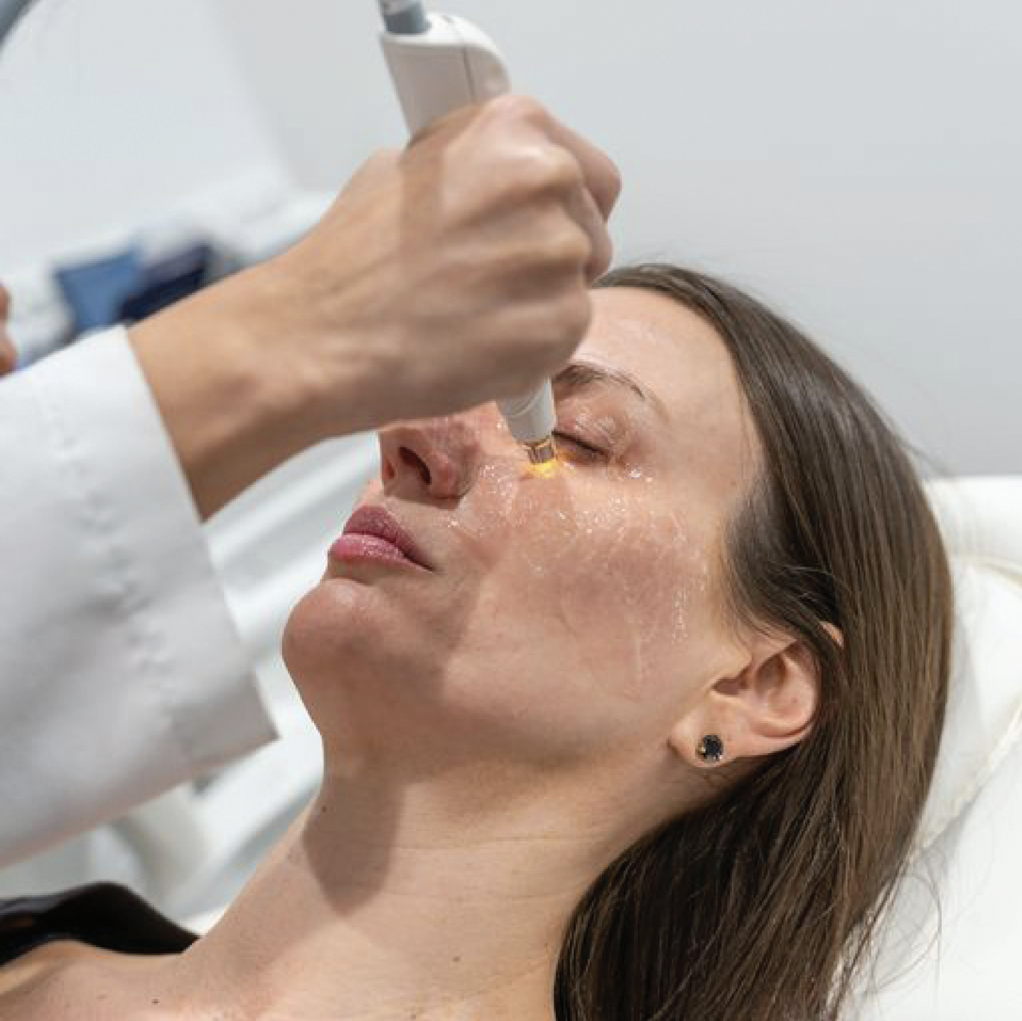 Although the scope of practice in South Dakota has not been updated in nearly 30 years, a new declaratory ruling will allow those with the proper training to perform intense pulsed light therapy on patients suffering from dry eye/MGD. 