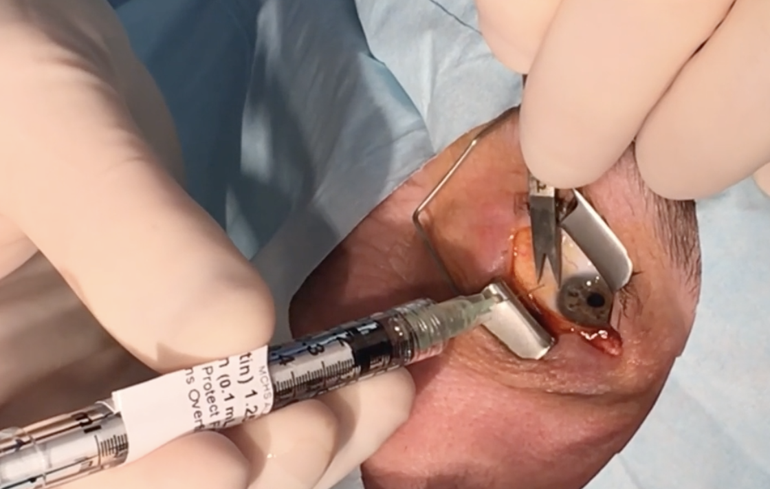 Access to care may be a factor in regional variation in intravitreal injections.