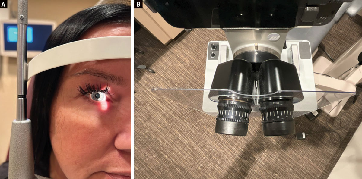 Fig. 2. (a) It is important to properly align the patient’s canthus with the mark on the slit lamp post. (b) The eyepieces should be neutralized for the examiner’s prescription and adjusted for their correct PD.