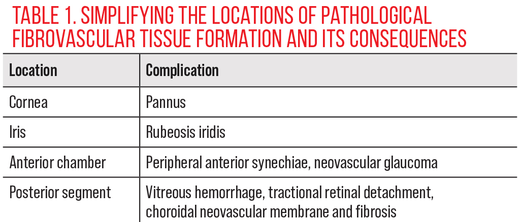 Table 1. Simplifying the Locations of Pathological Fibrovascular Tissue Formation and its Consequences