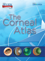 The 2011 Corneal Atlas