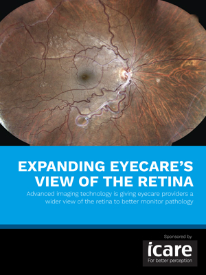 Expanding Eyecare's View of the Retina