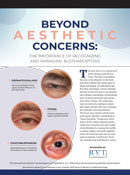 Beyond Aesthetic Concerns: The Importance of Recognizing and Managing Blepharoptosis